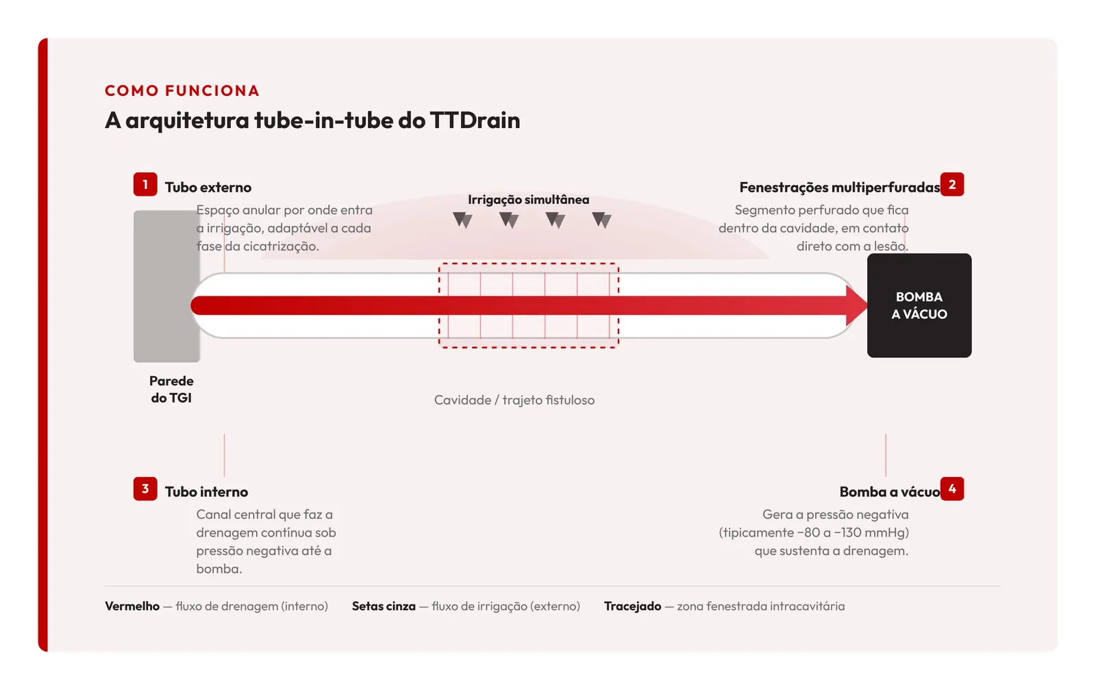 Esquema da arquitetura tube-in-tube do TTDrain: tubo externo, fenestrações multiperfuradas, tubo interno e bomba a vácuo